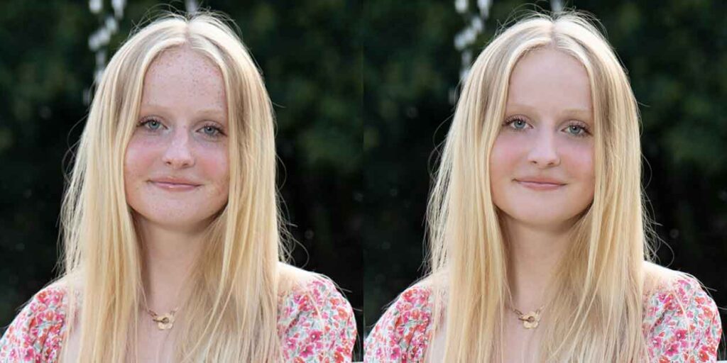 how to Remove Pimples And Scars in photoshop